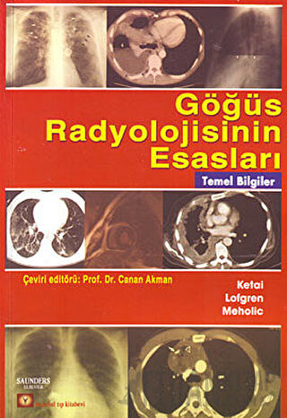 Göğüs Radyolojisinin Esasları Loren H. Ketai