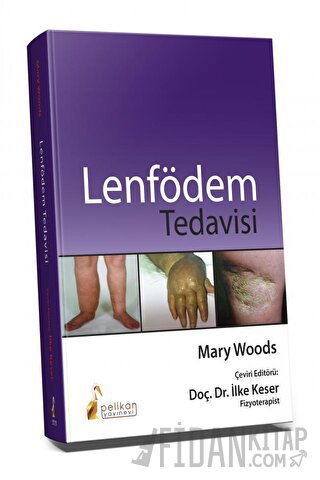 Lenfödem Tedavisi İlke Keser