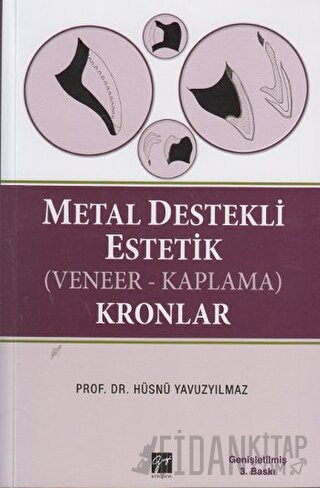 Metal Destekli Estetik (Veneer-Kaplama)Kronlar (Ciltli) Hüsnü Yavuzyıl