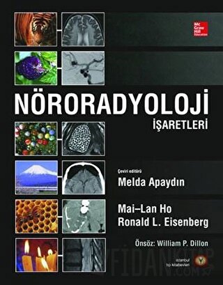 Nöroradyoloji İşaretleri (Ciltli) Mai-Lan Ho